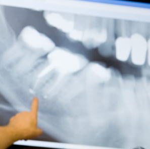 periodontal treatment Adelaide Reviews